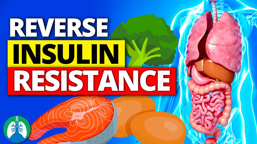 How to Reverse Insulin Resistance