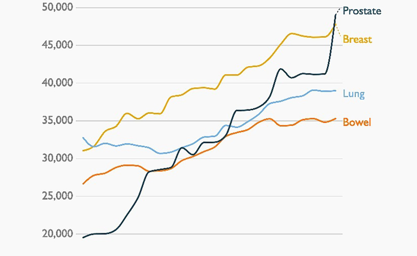 Prostate Cancer Overdiagnosis: Navigating the Hidden Epidemic