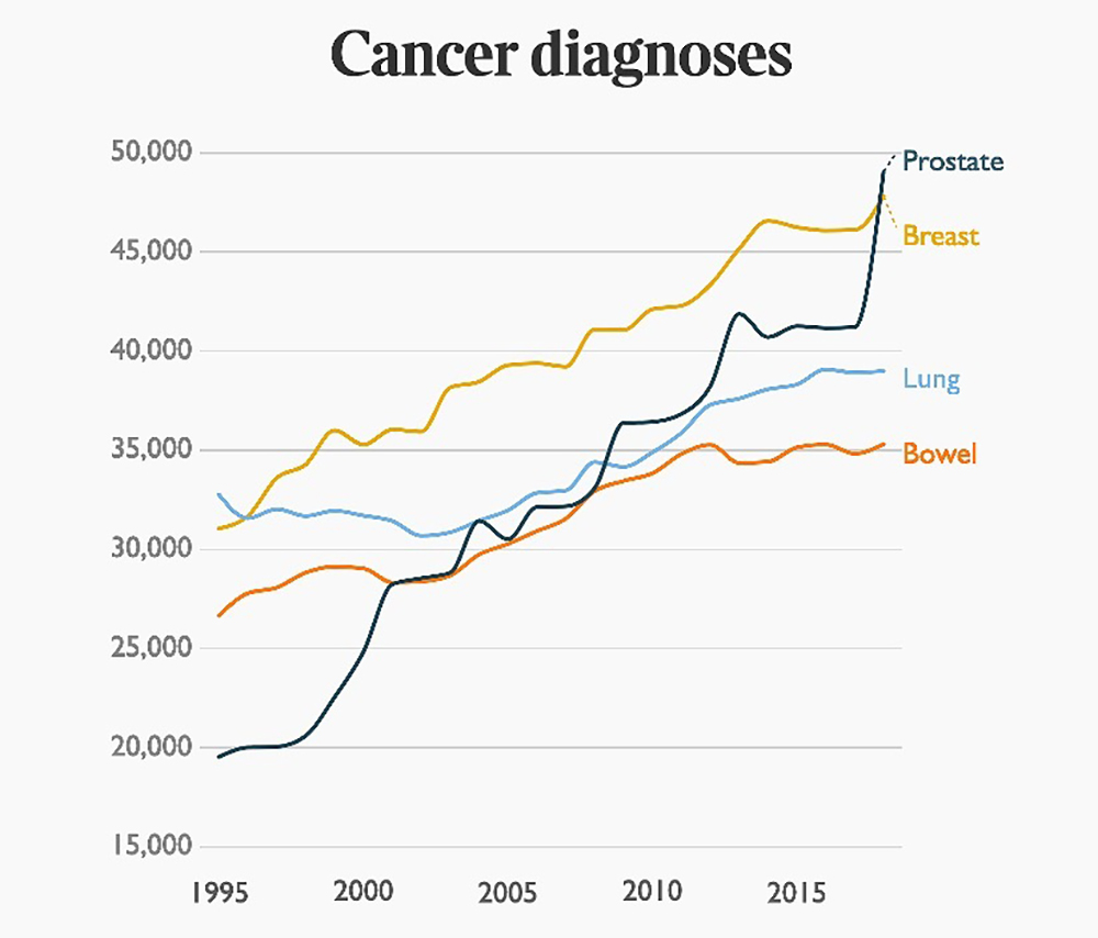 Prostate Cancer Overdiagnosis: Navigating the Hidden Epidemic