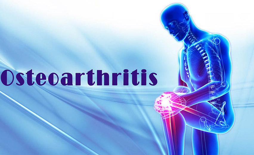 Study: Turmeric’s Curcumin Effectively Reduces Pain in Osteoarthritis Patients